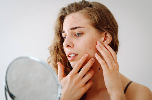 skin care